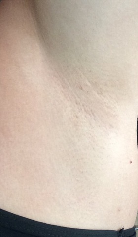 20561975_10213749869202178_1833838493_n